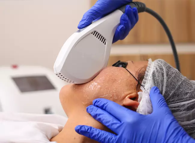 woman receiving ipl treatment