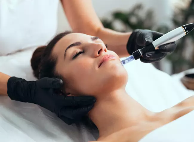 woman receiving microneedling treatment