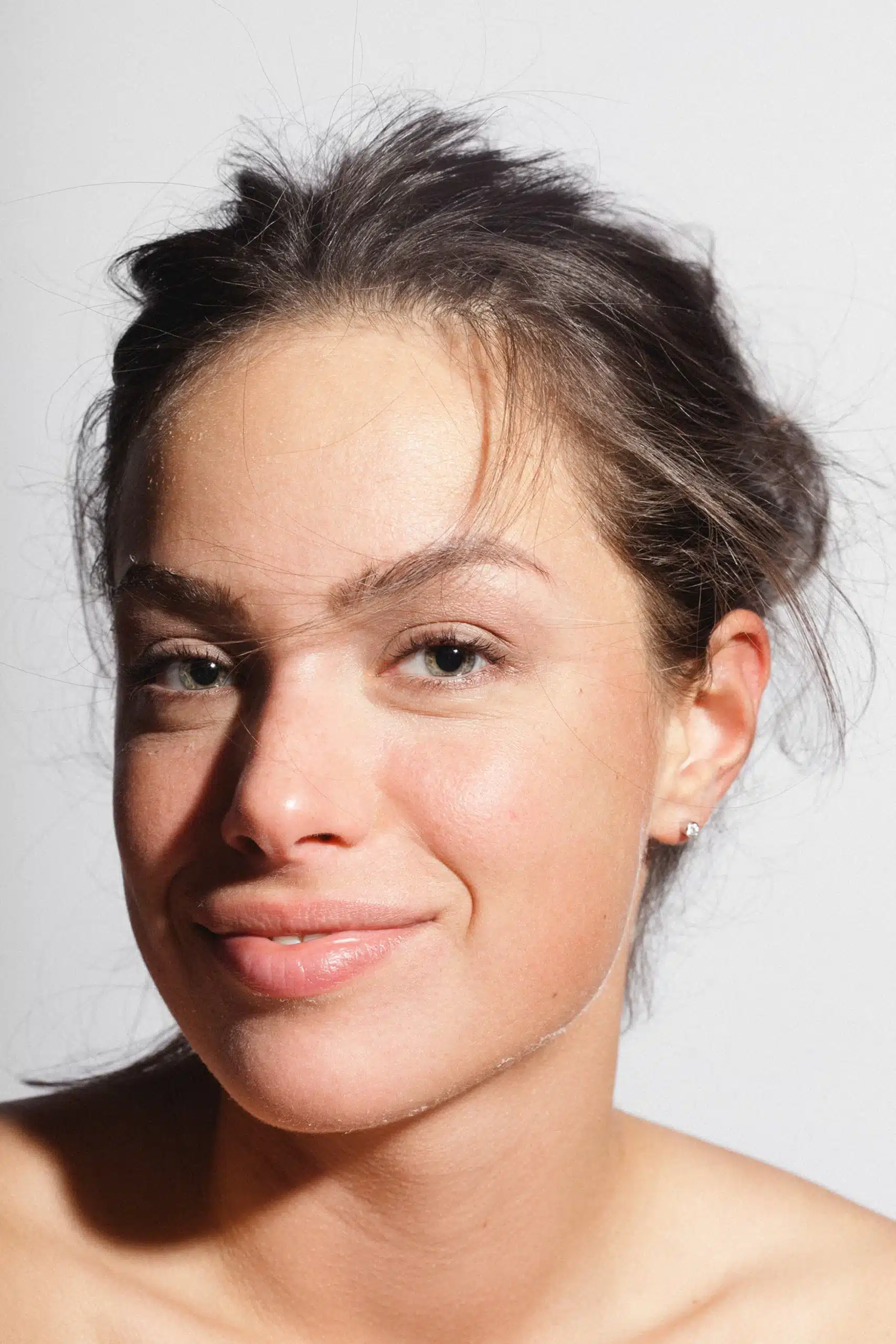 Flat Cheeks Treatments in Columbus, OH | The Luxe MedSpa