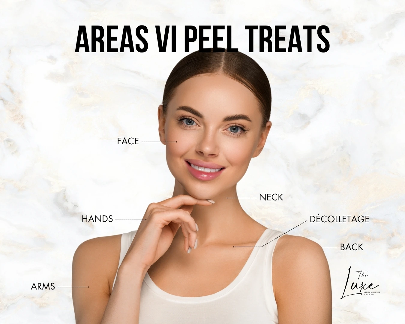 Areas VI Peel Treats