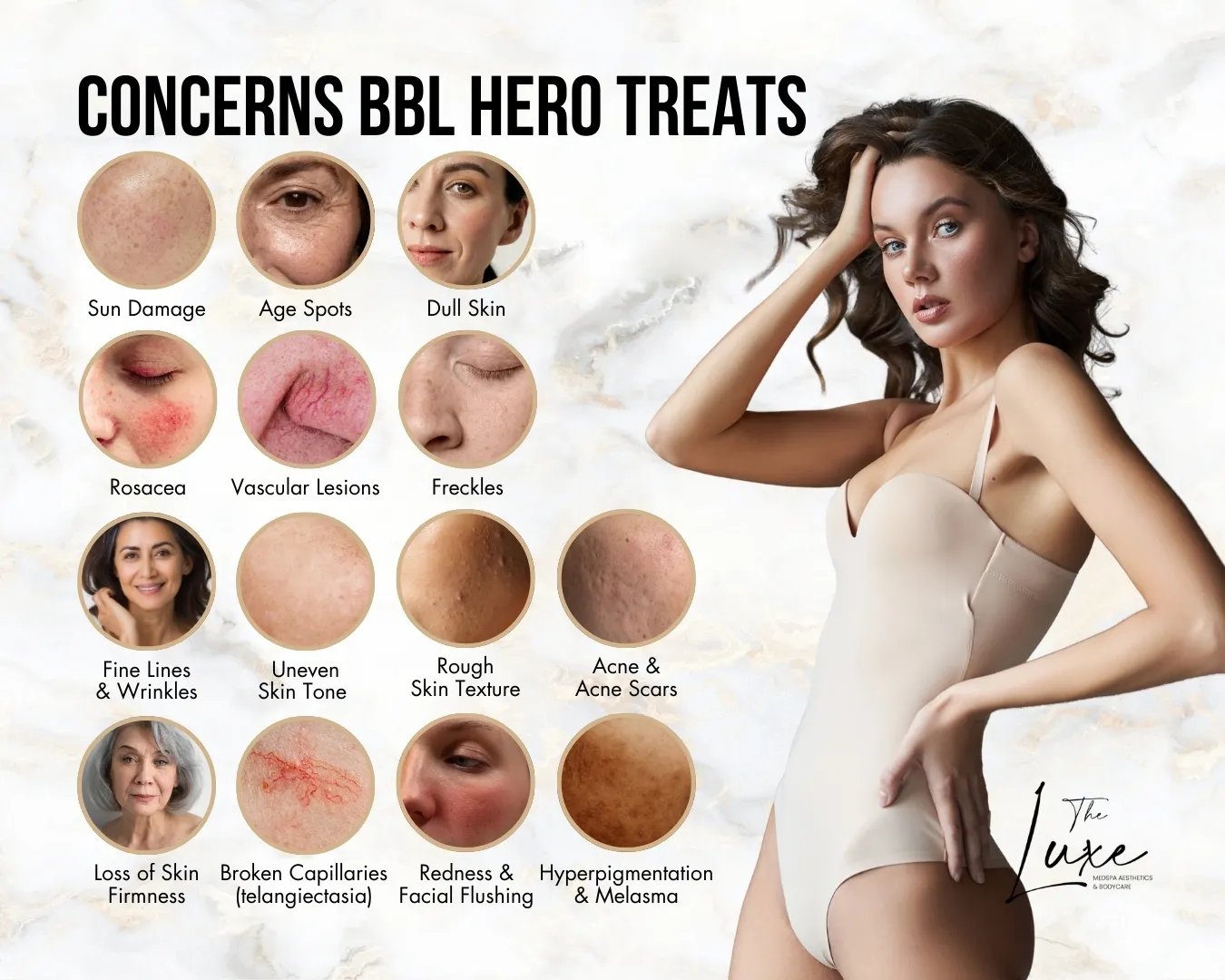 Graphic of woman with listing of concerns that BBL Hero treats